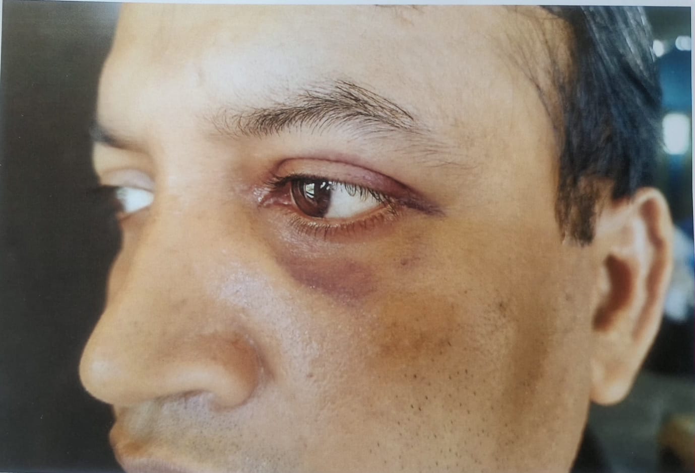 বরগুনায় স্কুলশিক্ষক অপহরণ, নির্যাতন ও লুট: থানায় মামলা